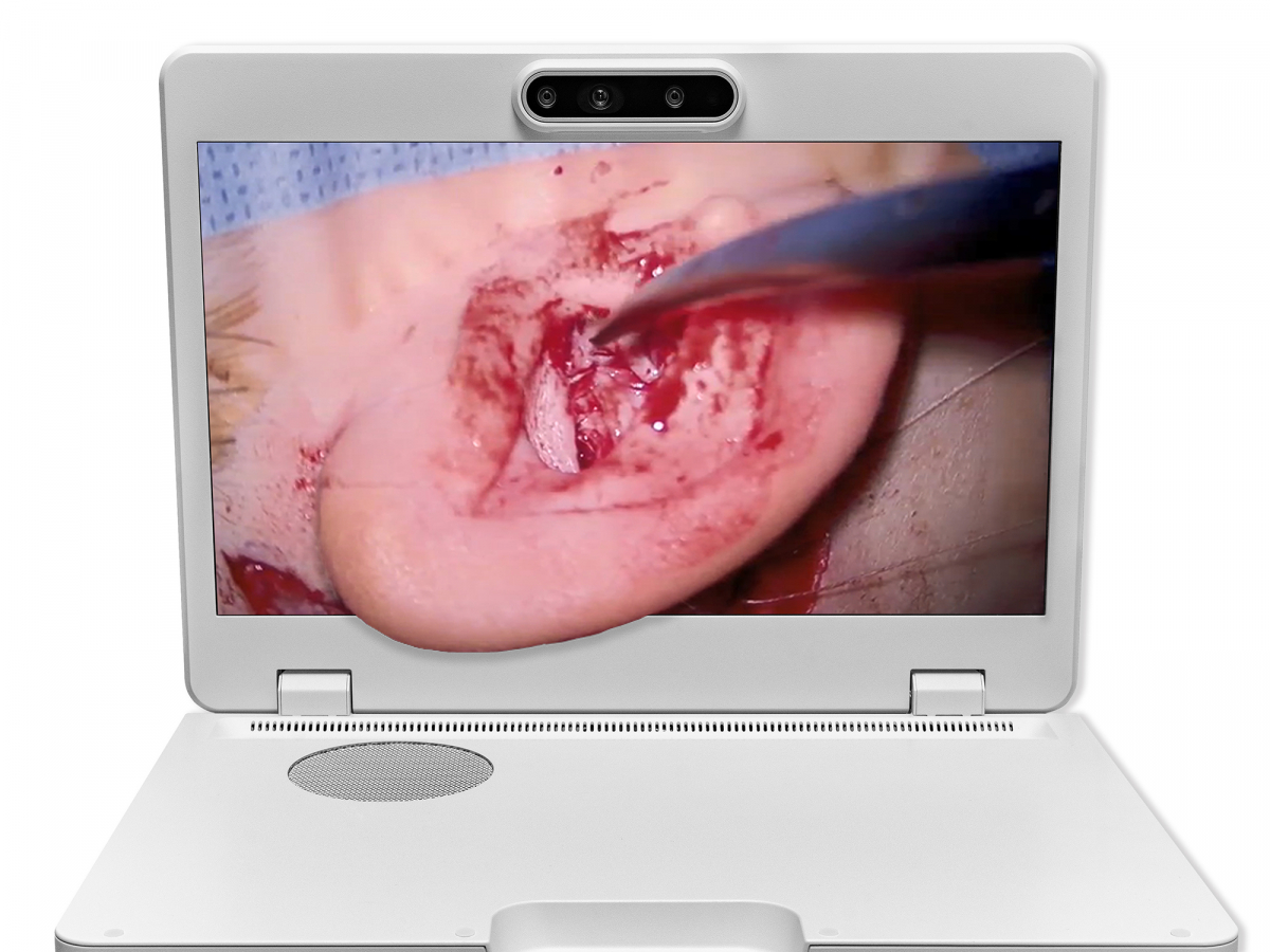 达擎之＂Heads-up 3D显微手术显示系统＂，整合4K裸眼3D显示及眼球追踪系统，具备快速追踪人眼移动位置功能，减轻医师长时间维持固定姿势的负担，让医师能有更宽广清晰的3D立体视野及更舒适的姿势来执行手术。